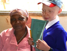 Projekte für Afrika - Albinismus in Afrika